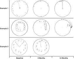 People with mild cognitive impairment (mci) scored an average of 22.1; Clock Drawing Test Neupsy Key