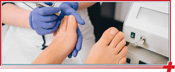 ingrown toenail removal specialist