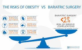 obesity vs bariatric surgery which is