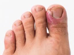 toe joint pain causes treatment