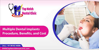 multiple dental implants procedure