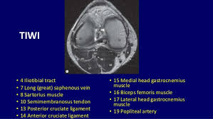 The muscles of the knee joint are incredibly important. Mri Anatomy Of Knee Dr Muhammad Bin Zulfiqar