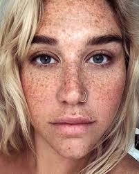 celebrities you forgot had freckles