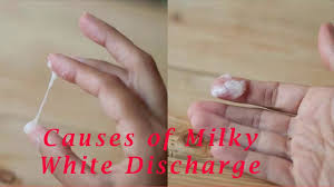 milky white discharge early pregnancy