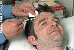 Desired effect: Paul Antrobus, 33, sought the procedure because &#39;it&#39;s very much the trendy thing to do. It&#39;s just fabulous. I&#39;d get it done again in an ... - health-graphics-20_1306203a