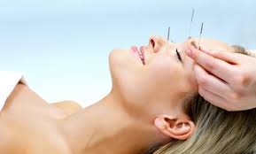 omaha acupuncture deals in and near