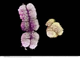 One pair determine the gender of the child.a female will have xx chromosomes and males. Zellenaustausch In Der Pranatalen Phase Starkt Mutter Und Kind