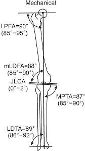 limb deformity correction