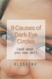 9 causes of dark eye circles take