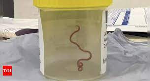 worm neurosurgeon investigating