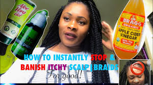 After two months, hair will grow in and may cause. How To Instantly Stop And Banish Itchy Scalp Braids For Good Youtube