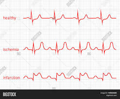Heart Cardiogram Vector Photo Free Trial Bigstock