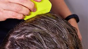 Hair dye will not kills nits as nits have a solid shell coating that can't be penetrated with chemicals. Does Hair Dye Kill Lice Or Their Eggs Complete Guide