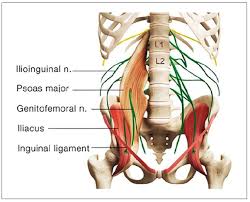 lumbar disc herniation