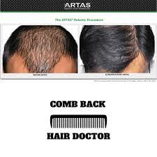 The artas hair restoration system produces the most realistic hair transplant results using robotic ai technology. Hair Restoration San Diego Hair Restoration San Diego