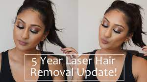 5 year full body laser hair removal