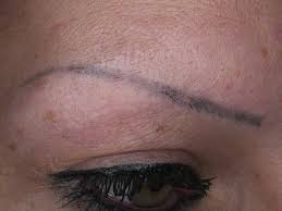 permanent makeup and how is it removed