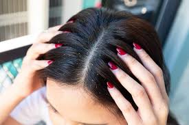 dry and itchy scalp causes and