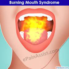 burning mouth syndrome causes symptoms