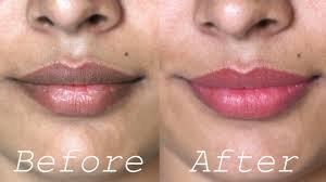 how to lighten dark lips naturally