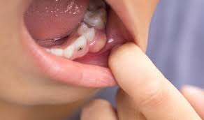 a tooth infection go untreated