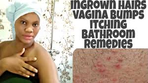 To help prevent ingrown hairs, avoid shaving, tweezing and waxing. How To Stop Ingrown Hairs Itching Vagin L Bumps From Shaving Waxing Shaving Tips For Women Youtube