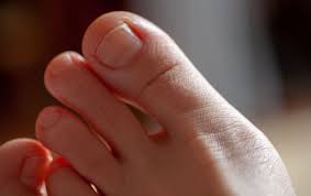 blister under your toenail here s how