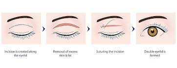 is it safe to use double eyelid tape