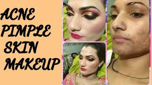 makeup on acne pimple skin hindi you