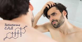 hair loss testosterone for men need