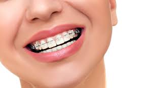 portalupi orthodontics