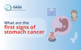what is the first sign of stomach cancer