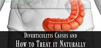 diverticulitis causes and how to treat
