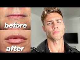 how to get bigger more attractive lips