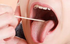 health risks of having your tonsils out
