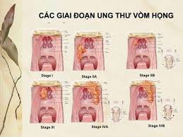 We did not find results for: 16 Cau Há»i Ung ThÆ° Vom Há»ng Ä'á»c Hiá»ƒu Ä'á»ƒ Phong Bá»‡nh Sá»›m Nháº¥t