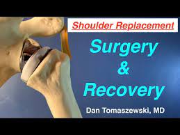 shoulder replacement surgery and