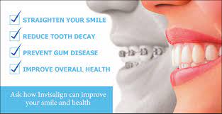 Check spelling or type a new query. Invisalign Cost Starts At 2 800 Cost Insurance Coverage Payment Plan