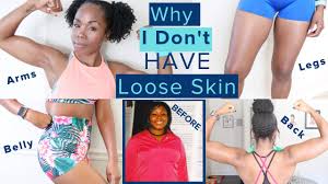 loose skin after 100 pound weight loss