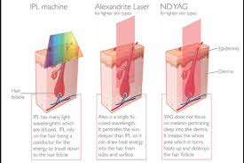 Us Laser Hair Removal Cost Prices In 2019