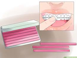 Otherwise, it will damage your brackets and wires. 3 Ways To Eat With Braces Wikihow