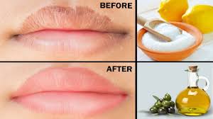 home remes for dry ed lips