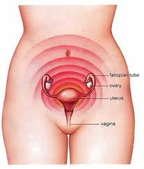 dysmenorrhea menstrual period crs nyc