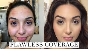how to cover acne breakouts dark spots with makeup