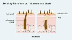 how-do-you-unclog-hair-follicles-for-hair-growth