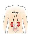 Chronic kidney disease - 