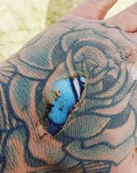 reddit users debate viral burnt tattoo