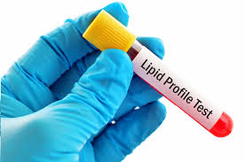 what is lipid profile dr lal
