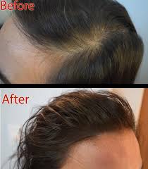 women hair health problems