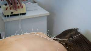 As of now acupuncture is not regulated in the province of ontario but it will be in the next year or so. Ontario To Start Regulating Traditional Chinese Medicine Herbal Remedies Ctv News